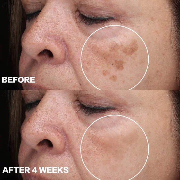 ❤️Imported Turmeric Anti Ageing Serum For🔥 Both Men & Women🔥