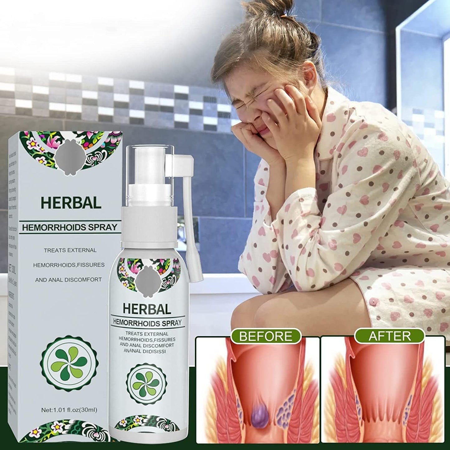 Herbal Hemorrhoids Spray 🔥BUY 1 GET 1 Free🔥