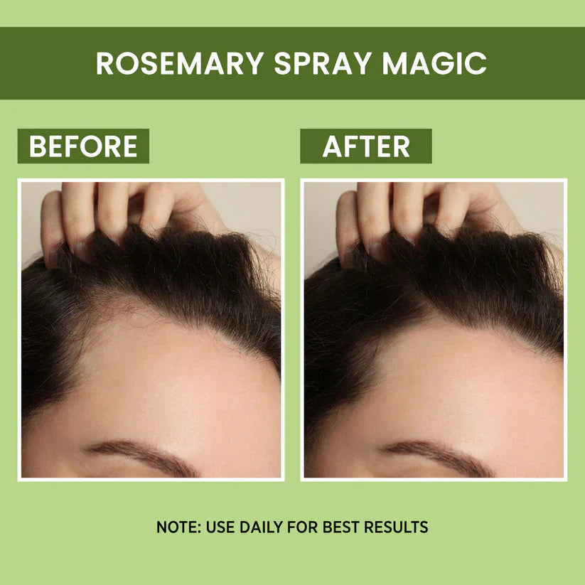 Rosemary Water, Hair Spray For Regrowth (Pack of 2) | 100 ml each