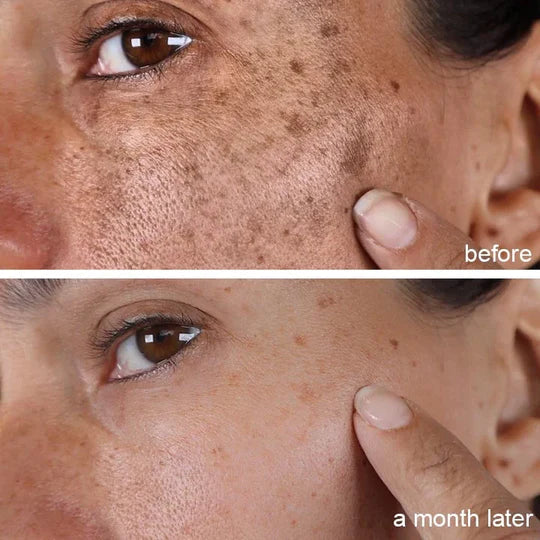 ❤️Imported Turmeric Anti Ageing Serum For🔥 Both Men & Women🔥